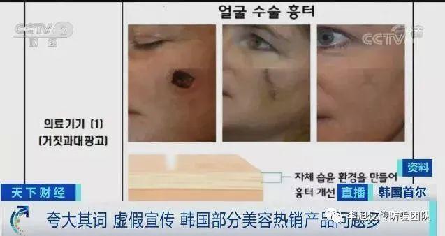 曝光！这些网红韩国爆款减肥霜、疤痕贴 涉嫌虚假宣传！国内电商在售插图4