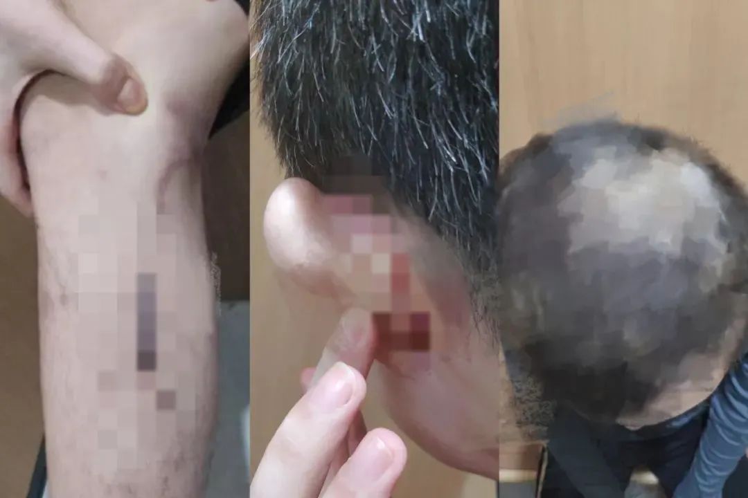 “海外高薪工作”？先问问自己“抗不抗揍”吧插图5