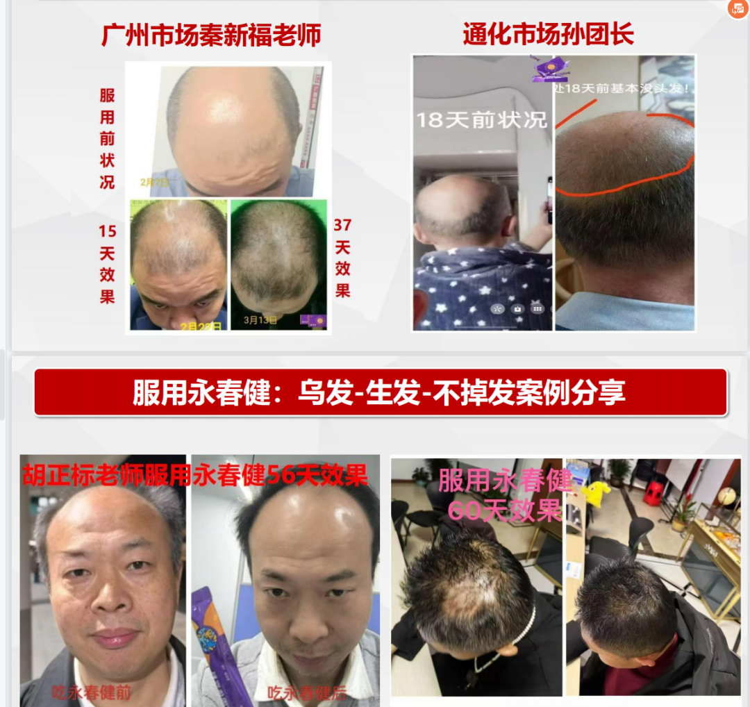 揭露“青岛康尔”宣传的“永春健”固态饮料涉嫌夸大宣传!插图1 揭露“青岛康尔”宣传的“永春健”固态饮料涉嫌夸大宣传!插图1