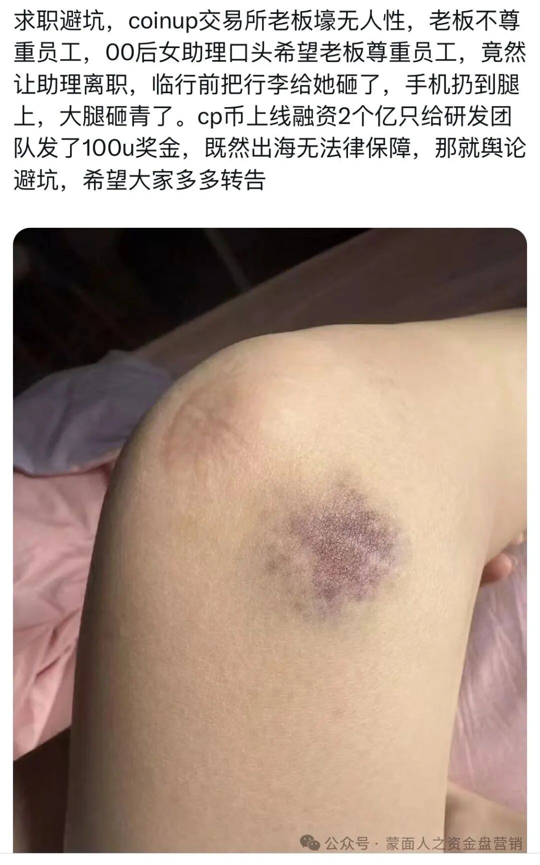 Coinup被深圳警方立案,深扒操盘手黑历史!!插图17 Coinup被深圳警方立案,深扒操盘手黑历史!!插图17